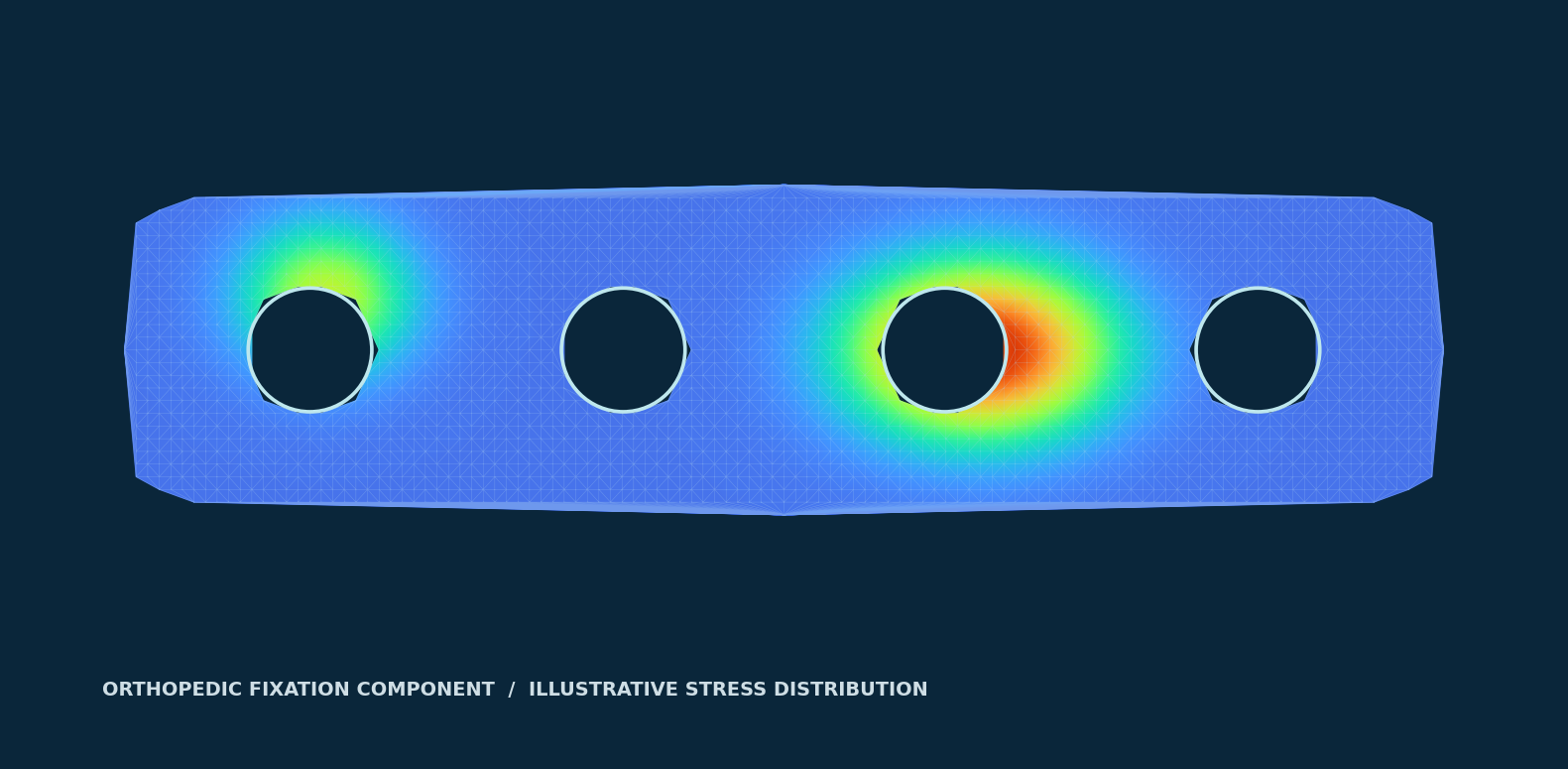 Engineering finite element mesh and illustrative stress contour on an orthopedic fixation plate